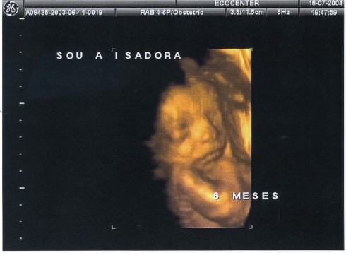 Ultra Maternidade no Divã Isadora